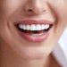 Transform Your Smile with Dental Implants Newcastle