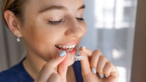 Invisalign Cost in Singapore: Why Prices Vary So Much Between Clinics