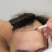 Top 5 Hair Transplant Clinics in Turkey for Celebrity-Grade Results