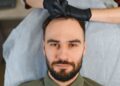 Top 10 Best Hair Transplant in Turkey